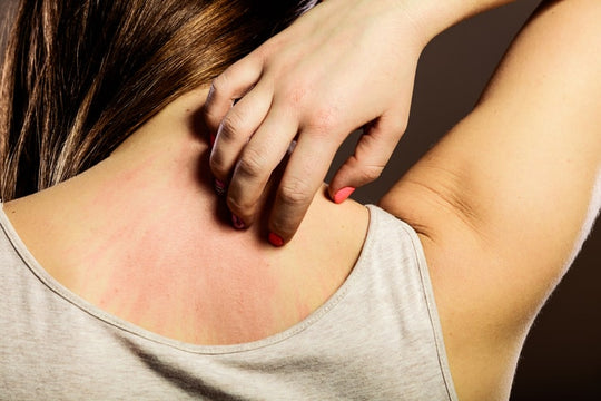 Rhinitis or Skin Allergies? Your Pillow, Bedsheets, and Blanket Could Be the Real Trigger